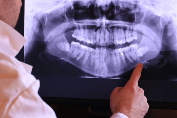 Best Emergency Broken Tooth Repair in Lealman, FL